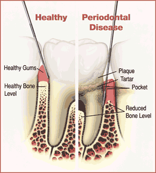 toothdiagram.gif